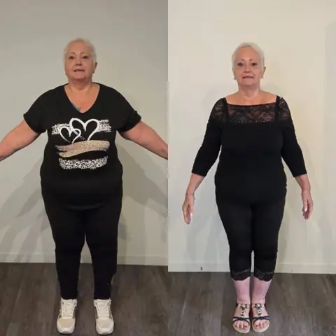 De face, avant puis après, une membre en montage au club St. Martin Nutrition