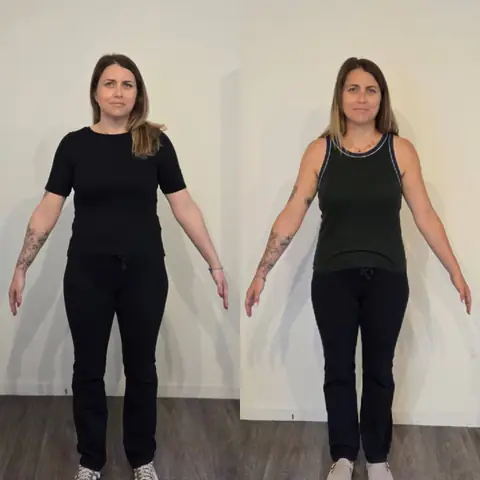 De face, avant puis après, une membre en montage au club St. Martin Nutrition